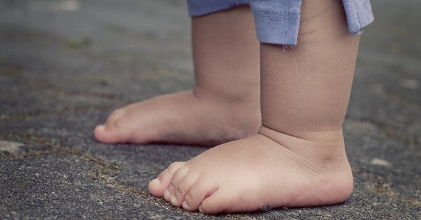 Điều trị cho trẻ bị bàn chân bẹt như thế nào?