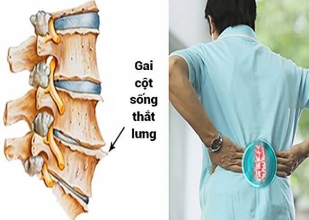 gai-cot-song-that-lung